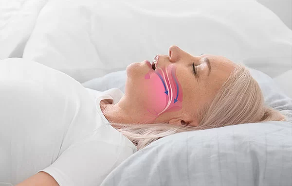 Addressing Sleep Disorders in Adults